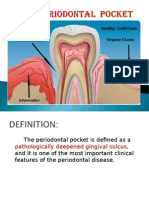 Periodontal Pocket