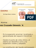 Expo EDEMA de Origen Cardiaco y Renal .