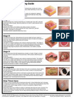 Pressure Ulcer Guide 8 08