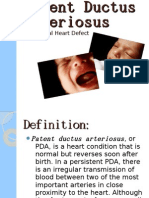 Patent Ductus Arteriosus