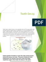 Tooth Decay