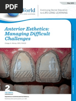 Anterior Esthetics - Managing Difficult Challenges