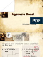 Agenesia Renal