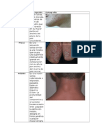 Lesiones de La Piel