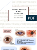 Conjuntivitis Bacteriana