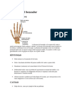 Fractura Del Boxeador