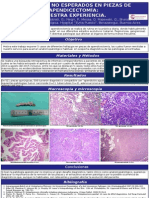 Hallazgos No Esperados en Piezas de Apendicectomía