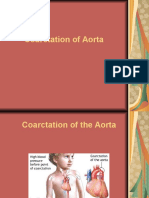 Coarctation of The Aorta