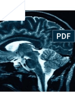 Electromagnetic Field and Human Brain