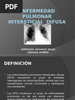 Enfermedad Pulmonar Intersticial Difusa