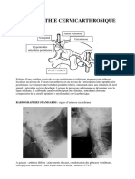 Lriffaudmyelopathie Cervicarthrosique - IMAGES