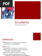 Encefalitis 