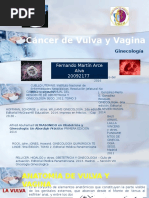 Cancer de Vulva y Vagina