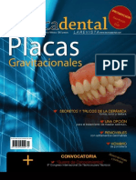 Alta Tecnica Dental - Placas Gravitacionales