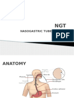 Nasogastric Tube Insertion