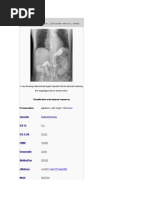 Gastric Reflux Disease, Acid Reflux Disease, Reflux