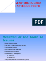 Sequelae of Injury To Anterior Teeth II Pedo