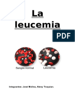 La Leucemia