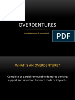 Overdenture Presentation PDF