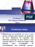 Eletroforese de Proteinas