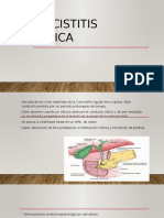 Colecistitis Crónica Terminado