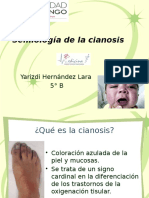 Semiología de La Cianosis