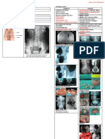 Obstructive Uropathy