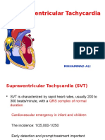 K7 - Supraventricular Tachycardia (SVT)