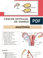 Cáncer Epitelial de Ovario