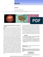 Caso Clinico - Adenocarcinoma