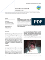 63 - CASE REPORT Epulis Granuloma