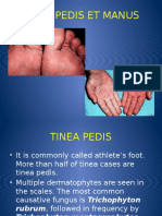 Tinea Pedis Et Manus