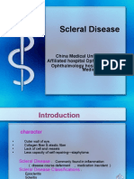 Sclera Diseases