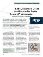 The Swing Lock Denture Its Use in Conventional Removable Partial Denture Prosthodontics PDF