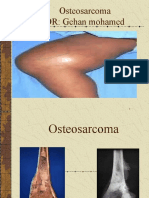 Osteosarcoma DR: Gehan Mohamed