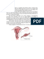 Ectopic Pregnancy - CS