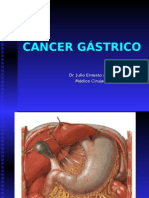 21 Cancer Gastrico