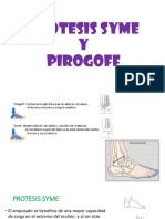 Protesis Syme y Pirogoff