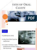 Cysts of Oral Cavity