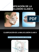 Clasificación de La Maloclusión Clase II