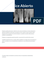 Endodoncia Apice Abierto Articulo