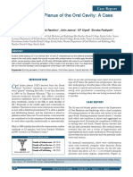 Erosive Lichen Planus of The Oral Cavity: A Case