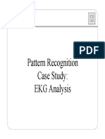 Pattern Recognition Case Study: EKG Analysis