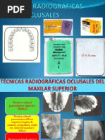 Tecnica Oclusal