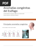 Anomalías Congénitas Del Esófago