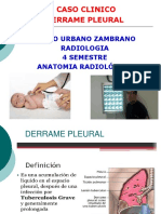 Caso Clinico Derrame Pleural