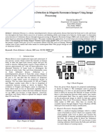 Brain Alzheimer's Disease Detection in Magnetic Resonance Images Using Image Processing