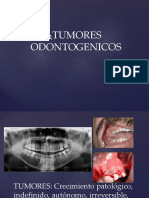 Tumores Odontogenicos