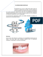 Fluorizaciones Dentales