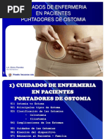 1 Ostomia 